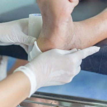 Diabetics Foot Care in the Ocean County, NJ: Toms River (Brick Township, Jackson Township, Berkeley Township, Lacey Township, Ocean Township, Beachwood) areas