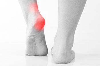 Ankle instability treatment in the Ocean County, NJ: Toms River (Brick Township, Jackson Township, Berkeley Township, Lacey Township, Ocean Township, Beachwood) areas