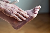 Navigating Poor Foot Circulation and Mobility