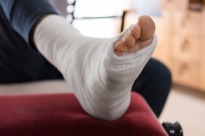 Understanding Foot Fractures