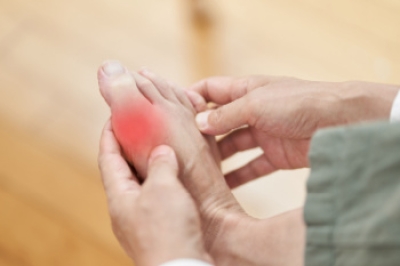 When Gout Leads to More Than Just Pain