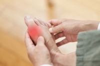 When Gout Leads to More Than Just Pain