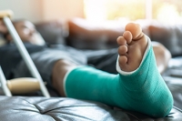 Understanding Metatarsal Fractures