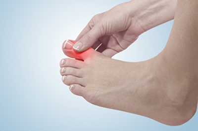 Understanding Causes of Gout and Accompanying Symptoms